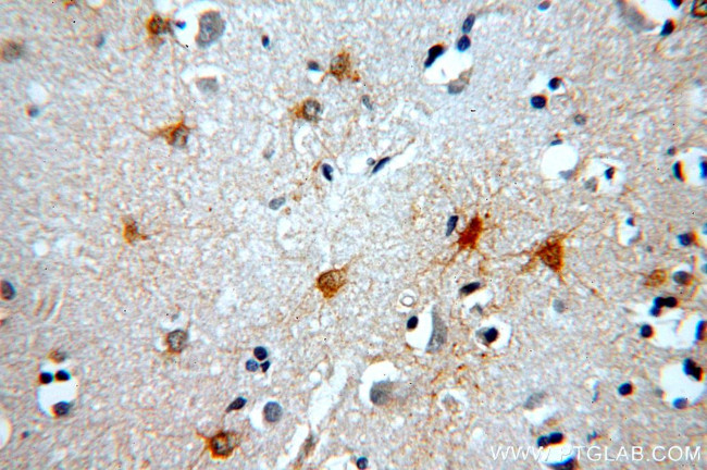 MT3 Antibody in Immunohistochemistry (Paraffin) (IHC (P))