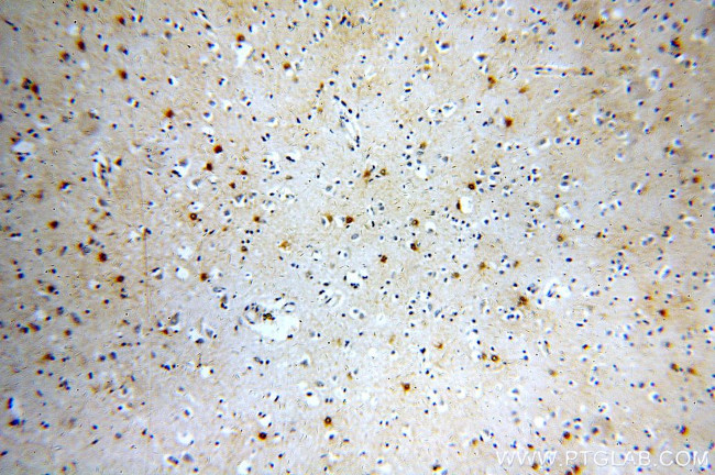 MT3 Antibody in Immunohistochemistry (Paraffin) (IHC (P))