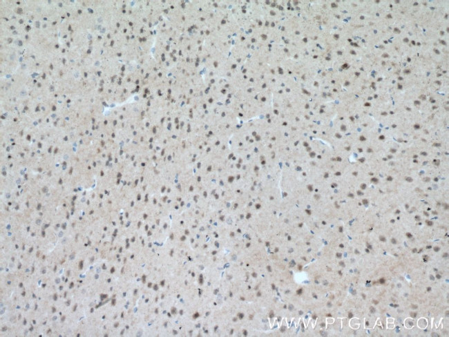 MT3 Antibody in Immunohistochemistry (Paraffin) (IHC (P))