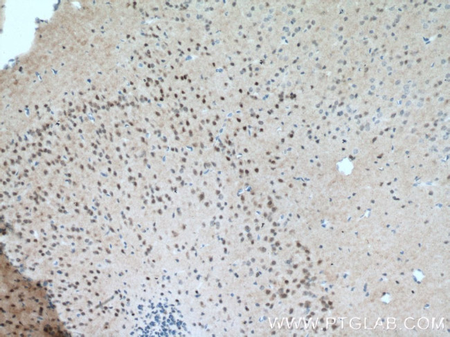 MT3 Antibody in Immunohistochemistry (Paraffin) (IHC (P))