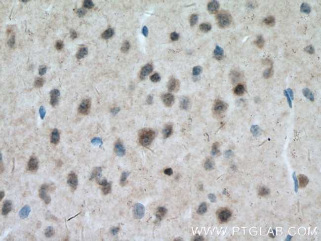 MT3 Antibody in Immunohistochemistry (Paraffin) (IHC (P))