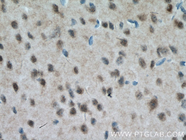 MT3 Antibody in Immunohistochemistry (Paraffin) (IHC (P))