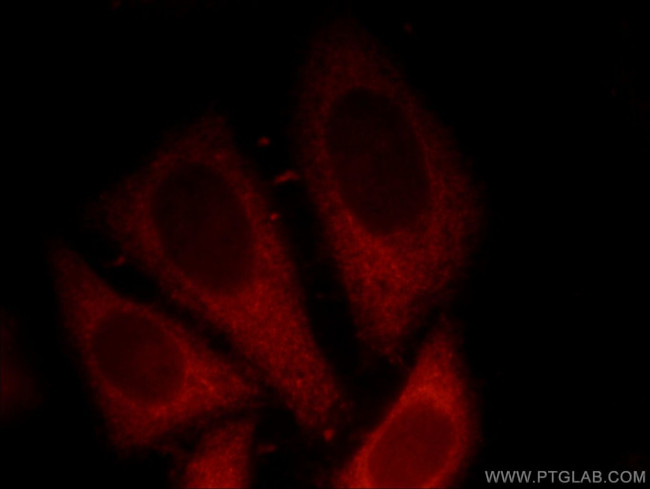 p120 Catenin Antibody in Immunocytochemistry (ICC/IF)