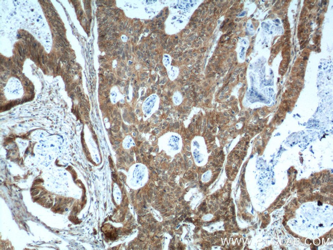 p120 Catenin Antibody in Immunohistochemistry (Paraffin) (IHC (P))