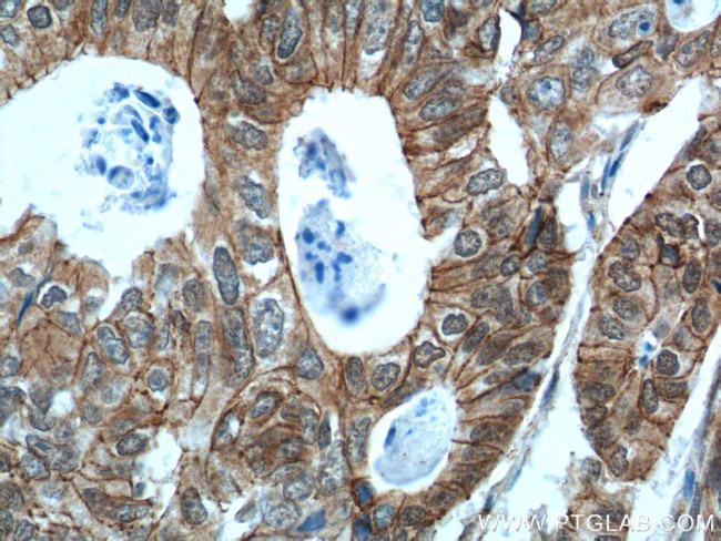 p120 Catenin Antibody in Immunohistochemistry (Paraffin) (IHC (P))