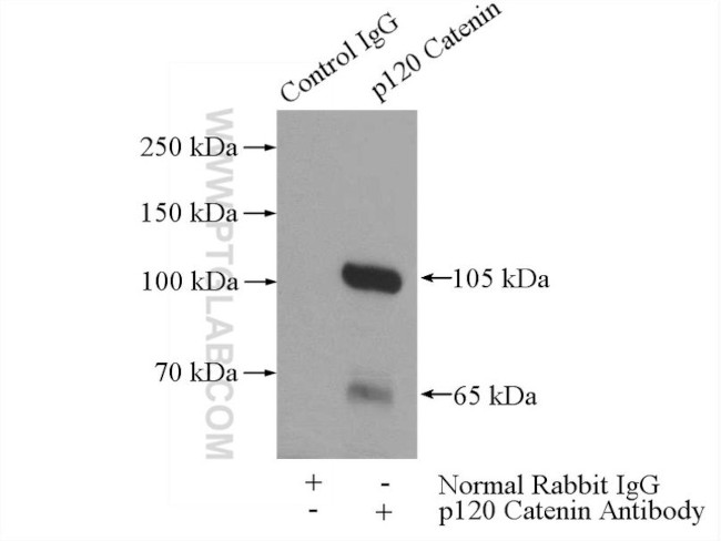 p120 Catenin Antibody in Immunoprecipitation (IP)