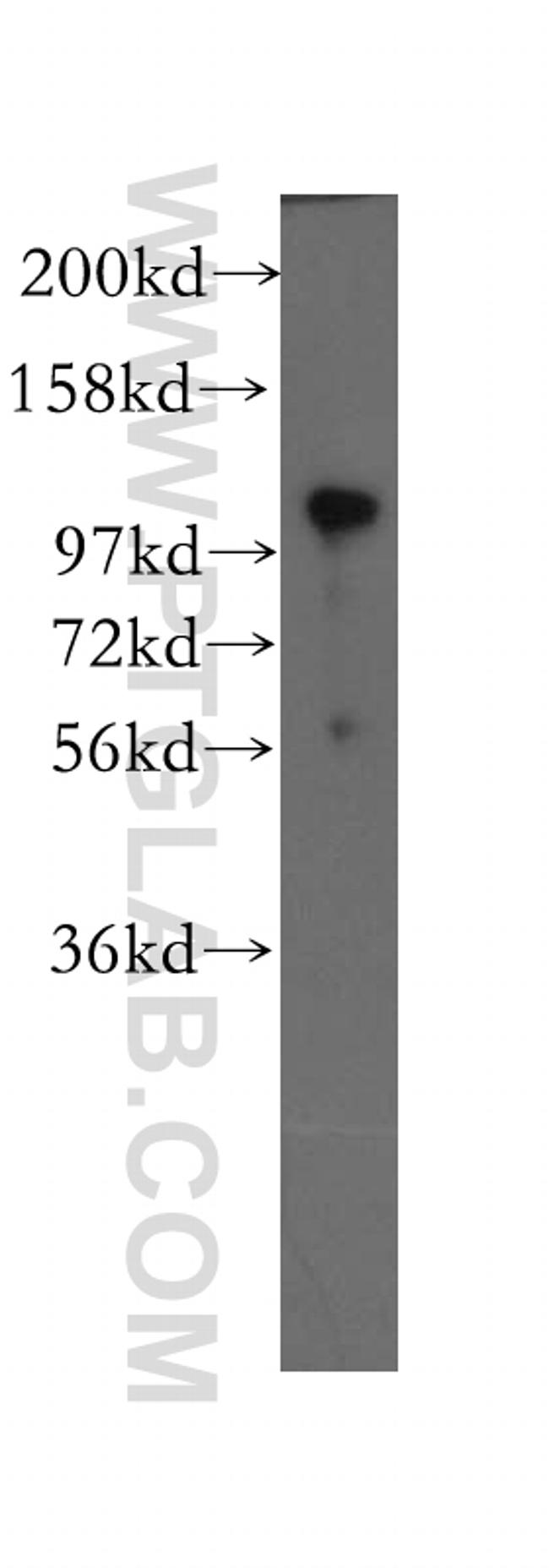 p120 Catenin Antibody in Western Blot (WB)