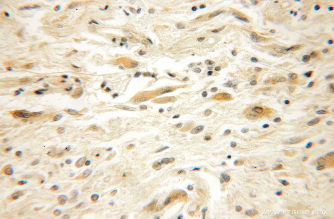 EFHD2 Antibody in Immunohistochemistry (Paraffin) (IHC (P))