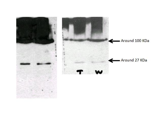 EFHD2 Antibody in Western Blot (WB)