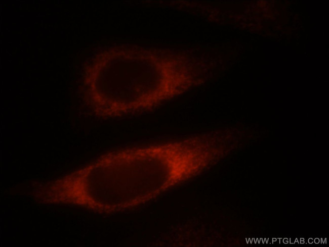 NDRG4 Antibody in Immunocytochemistry (ICC/IF)