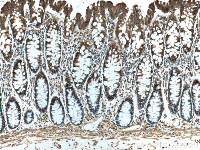 NDRG4 Antibody in Immunohistochemistry (Paraffin) (IHC (P))