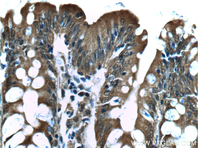 NDRG4 Antibody in Immunohistochemistry (Paraffin) (IHC (P))