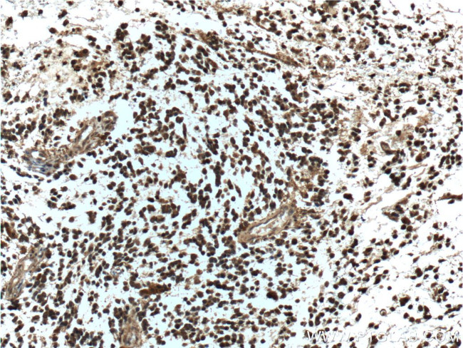 NDRG4 Antibody in Immunohistochemistry (Paraffin) (IHC (P))