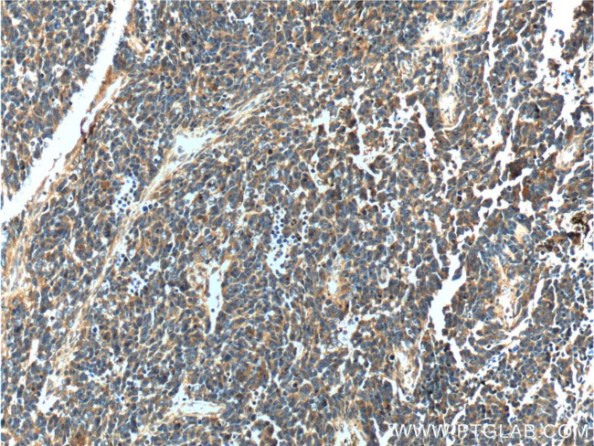 NDRG4 Antibody in Immunohistochemistry (Paraffin) (IHC (P))