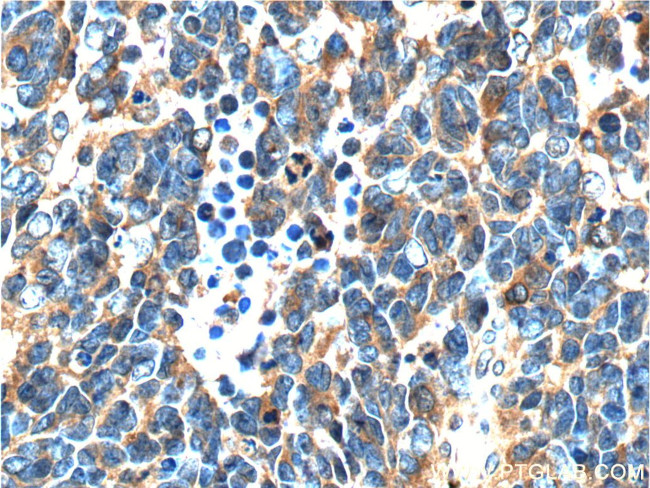 NDRG4 Antibody in Immunohistochemistry (Paraffin) (IHC (P))