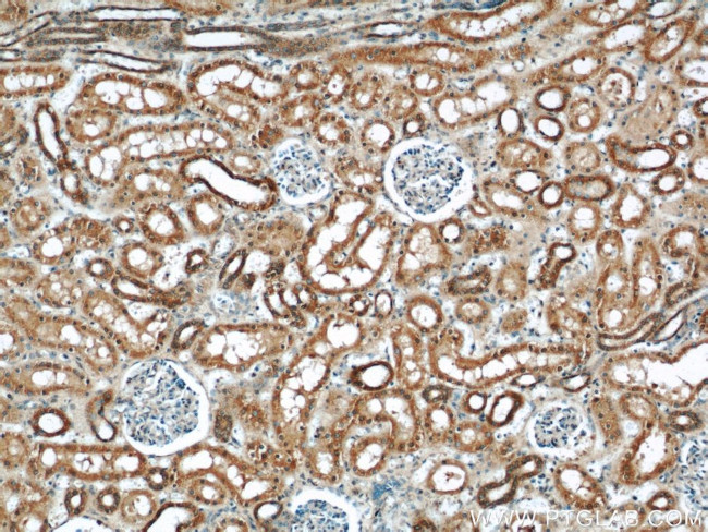 MFN2 Antibody in Immunohistochemistry (Paraffin) (IHC (P))