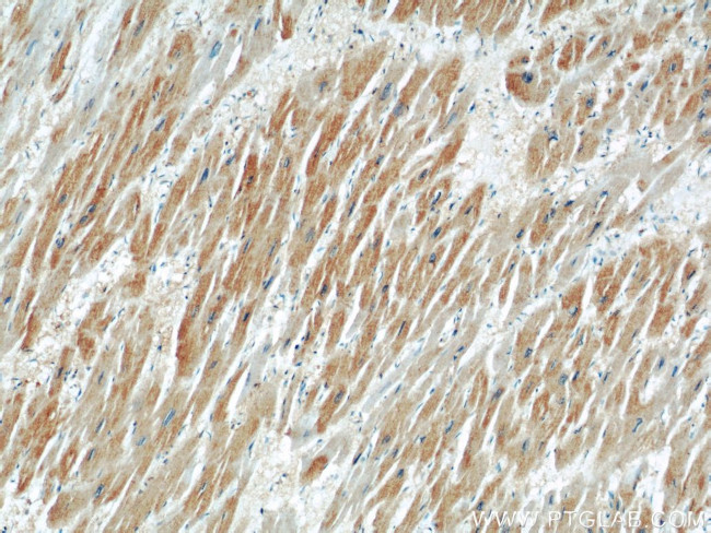 MFN2 Antibody in Immunohistochemistry (Paraffin) (IHC (P))