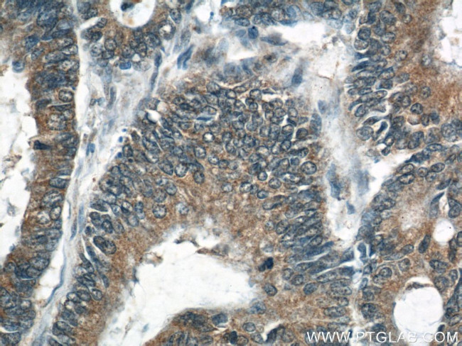 MFN2 Antibody in Immunohistochemistry (Paraffin) (IHC (P))