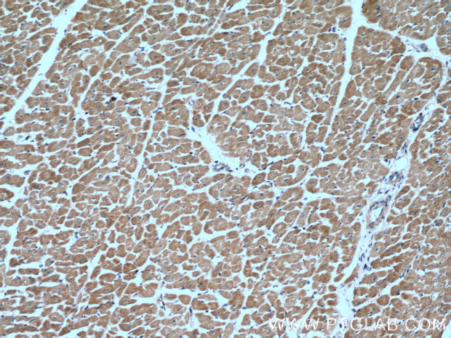 MFN2 Antibody in Immunohistochemistry (Paraffin) (IHC (P))