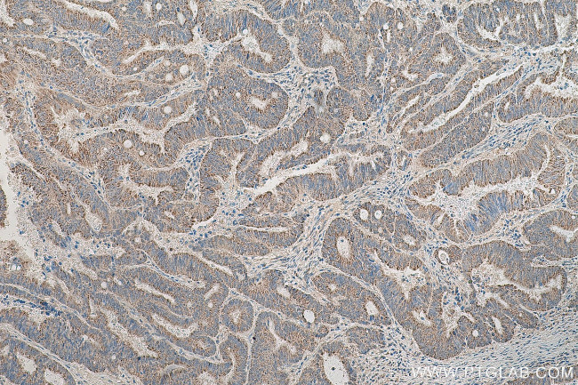 MFN2 Antibody in Immunohistochemistry (Paraffin) (IHC (P))