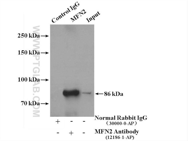 MFN2 Antibody in Immunoprecipitation (IP)