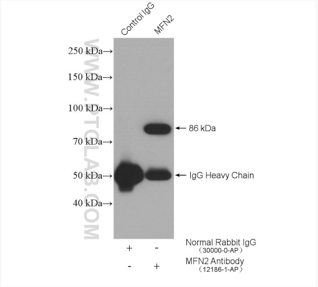 MFN2 Antibody in Immunoprecipitation (IP)