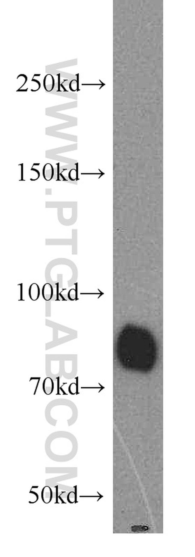 MFN2 Antibody in Western Blot (WB)