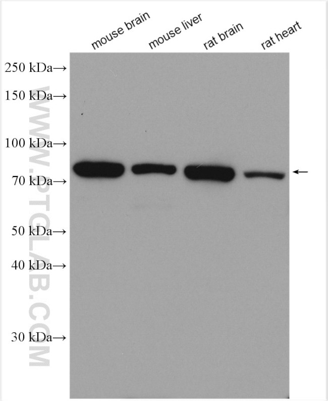 MFN2 Antibody in Western Blot (WB)