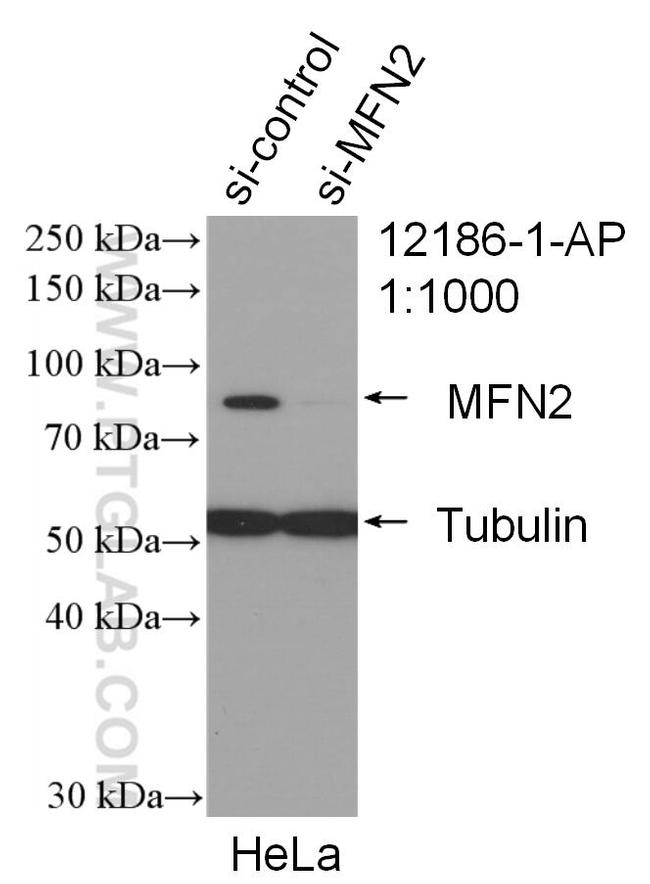 MFN2 Antibody in Western Blot (WB)