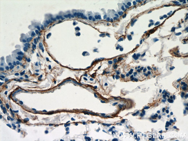 Fibulin 5 Antibody in Immunohistochemistry (Paraffin) (IHC (P))