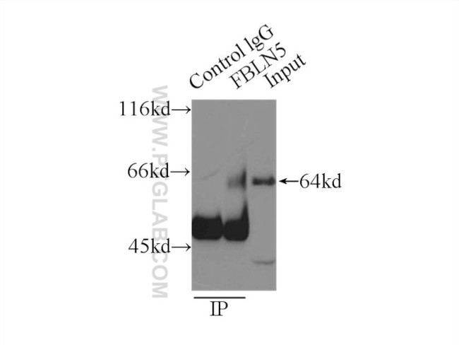 Fibulin 5 Antibody in Immunoprecipitation (IP)