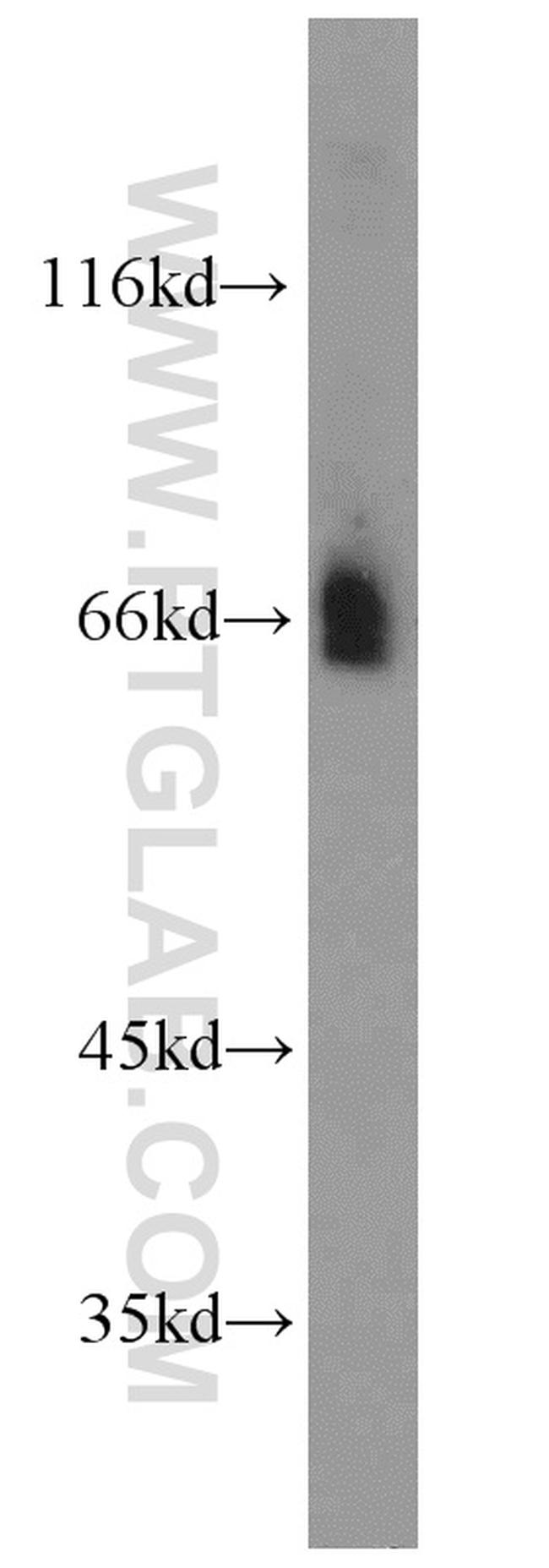 Fibulin 5 Antibody in Western Blot (WB)