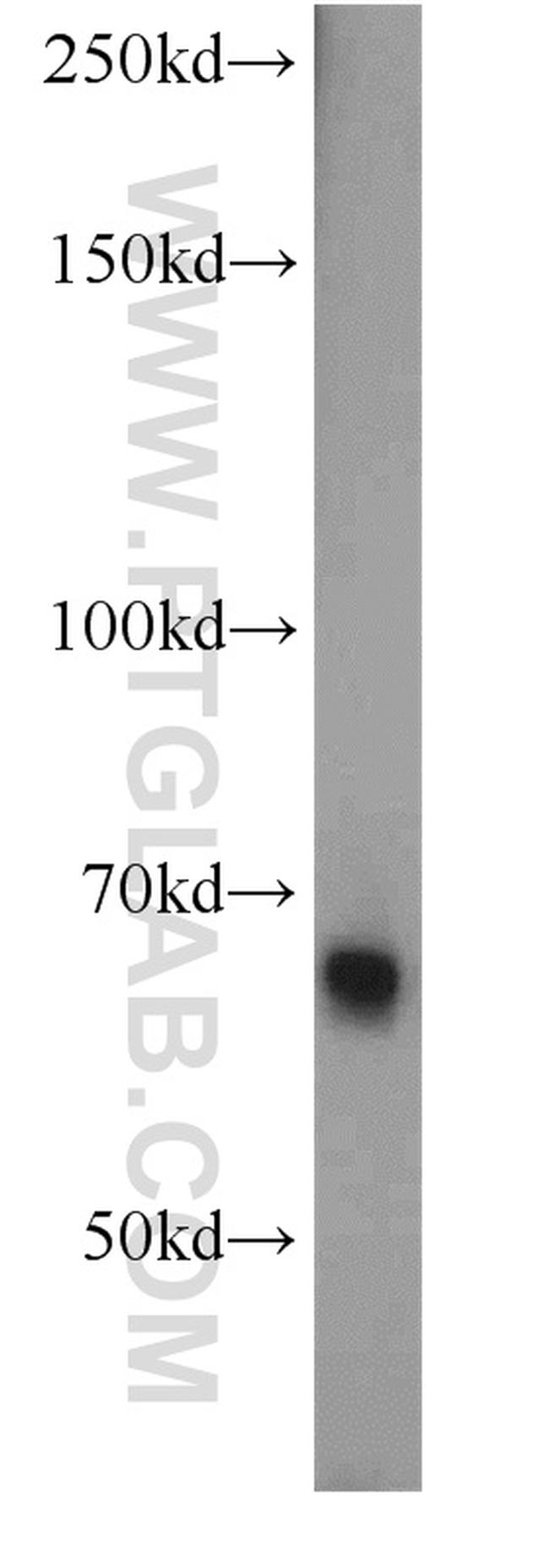 Fibulin 5 Antibody in Western Blot (WB)