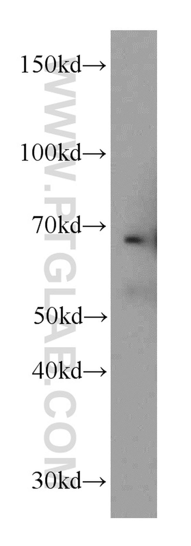 Fibulin 5 Antibody in Western Blot (WB)