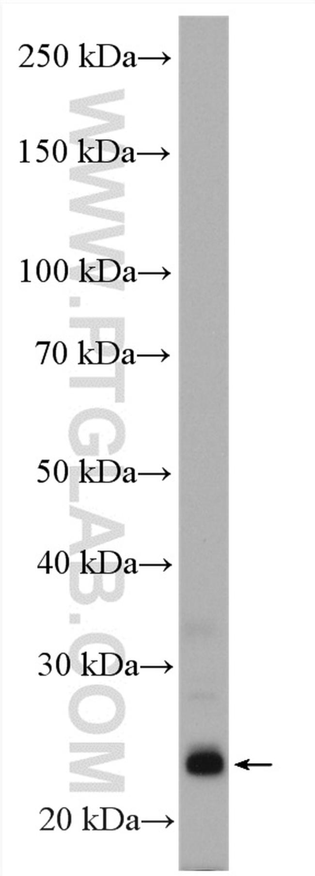 Endothelin 1 Antibody in Western Blot (WB)