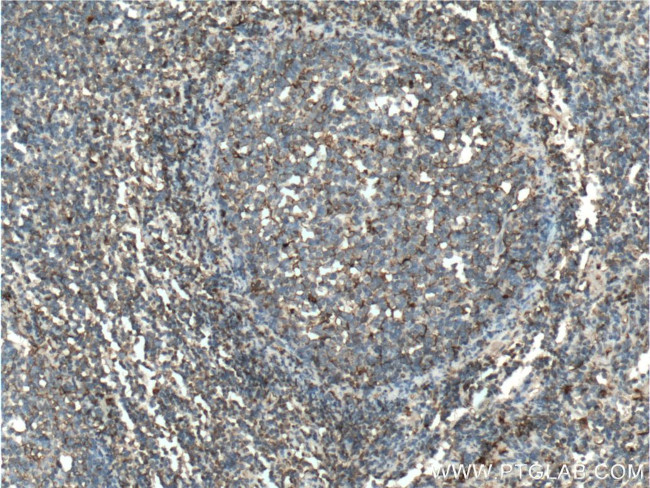 alpha 1 Antichymotrypsin Antibody in Immunohistochemistry (Paraffin) (IHC (P))