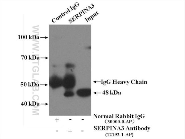 alpha 1 Antichymotrypsin Antibody in Immunoprecipitation (IP)