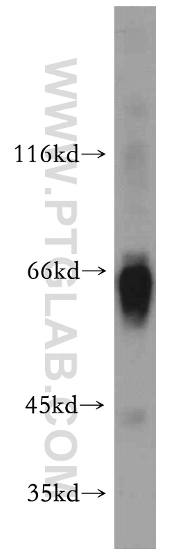 alpha 1 Antichymotrypsin Antibody in Western Blot (WB)