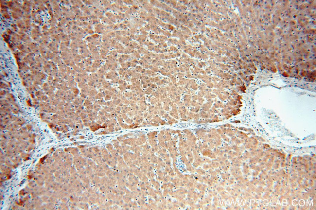 alpha 1 Antichymotrypsin Antibody in Immunohistochemistry (Paraffin) (IHC (P))