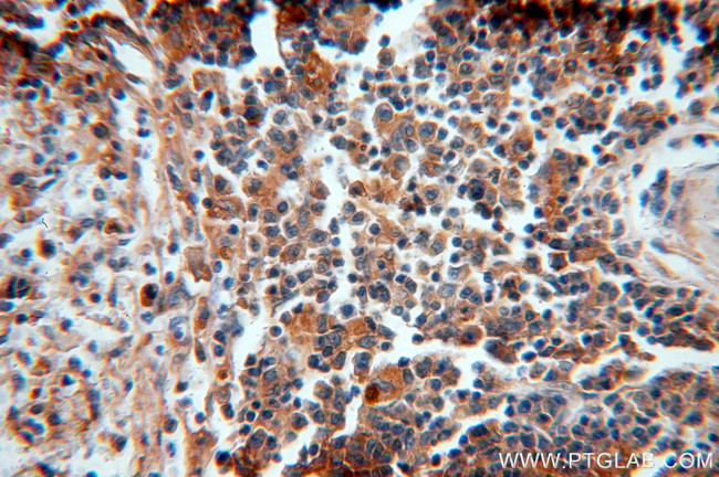 alpha 1 Antichymotrypsin Antibody in Immunohistochemistry (Paraffin) (IHC (P))