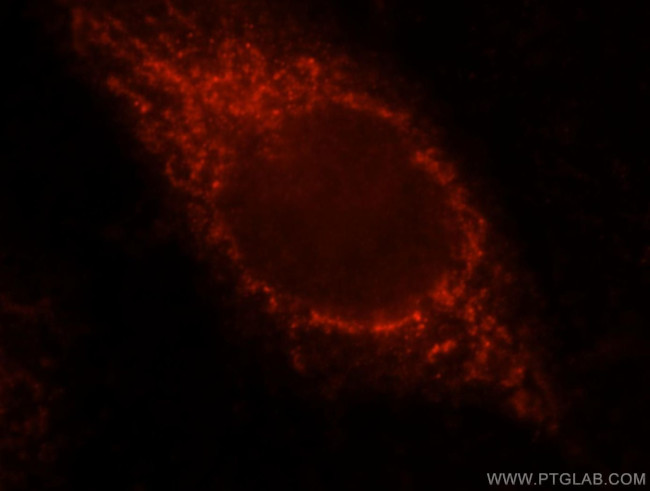 VPS33B Antibody in Immunocytochemistry (ICC/IF)