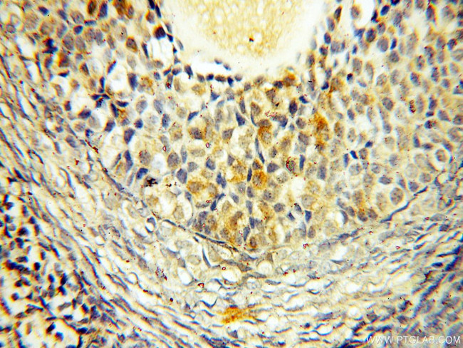 VPS33B Antibody in Immunohistochemistry (Paraffin) (IHC (P))