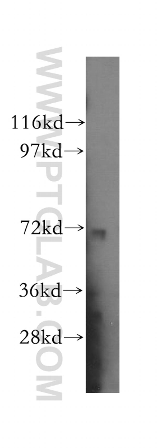 VPS33B Antibody in Western Blot (WB)