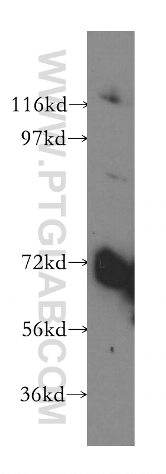 VPS33B Antibody in Western Blot (WB)