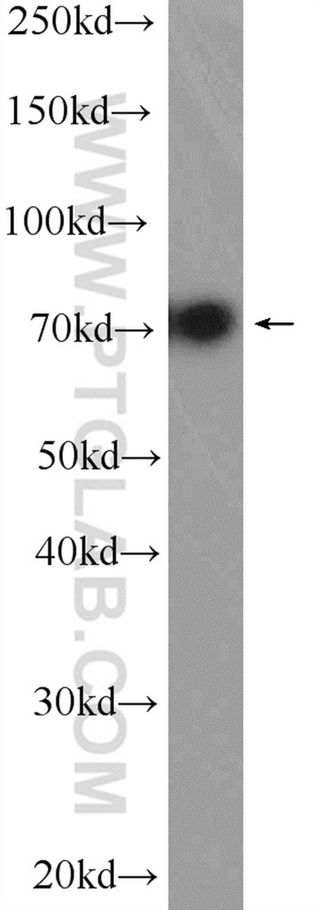 VPS33B Antibody in Western Blot (WB)