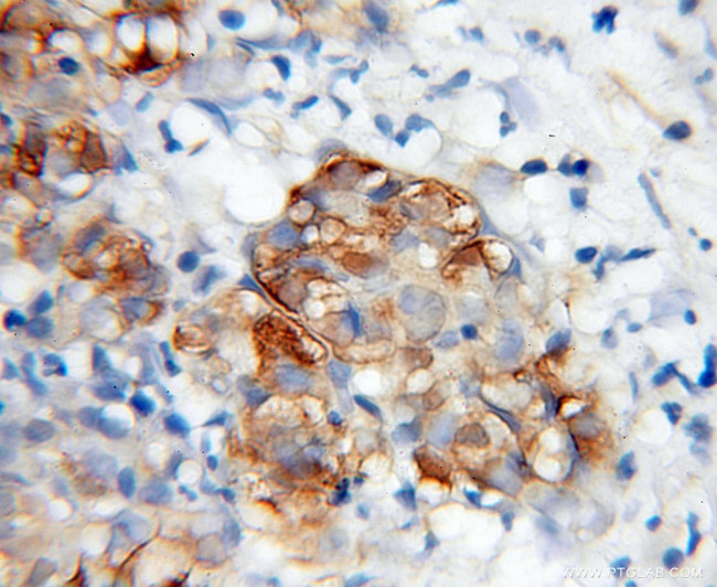 WWP2 Antibody in Immunohistochemistry (Paraffin) (IHC (P))