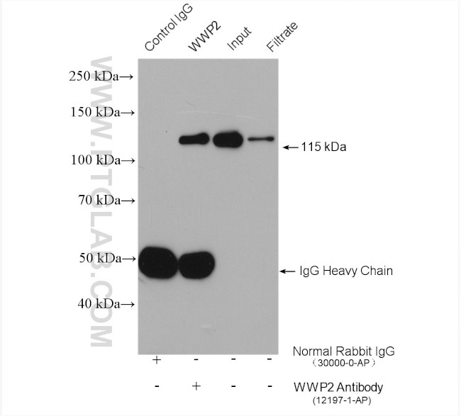 WWP2 Antibody in Immunoprecipitation (IP)