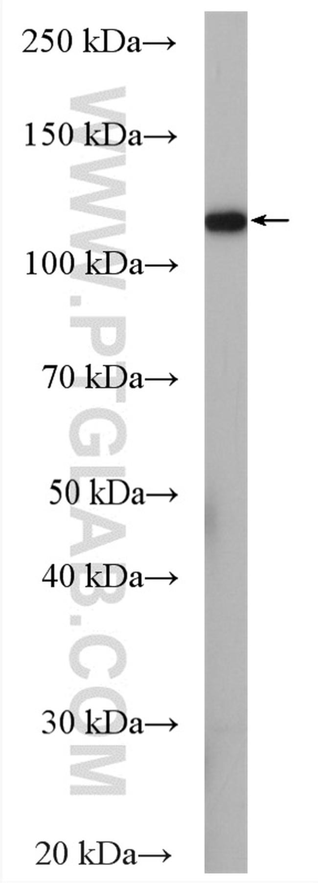 WWP2 Antibody in Western Blot (WB)