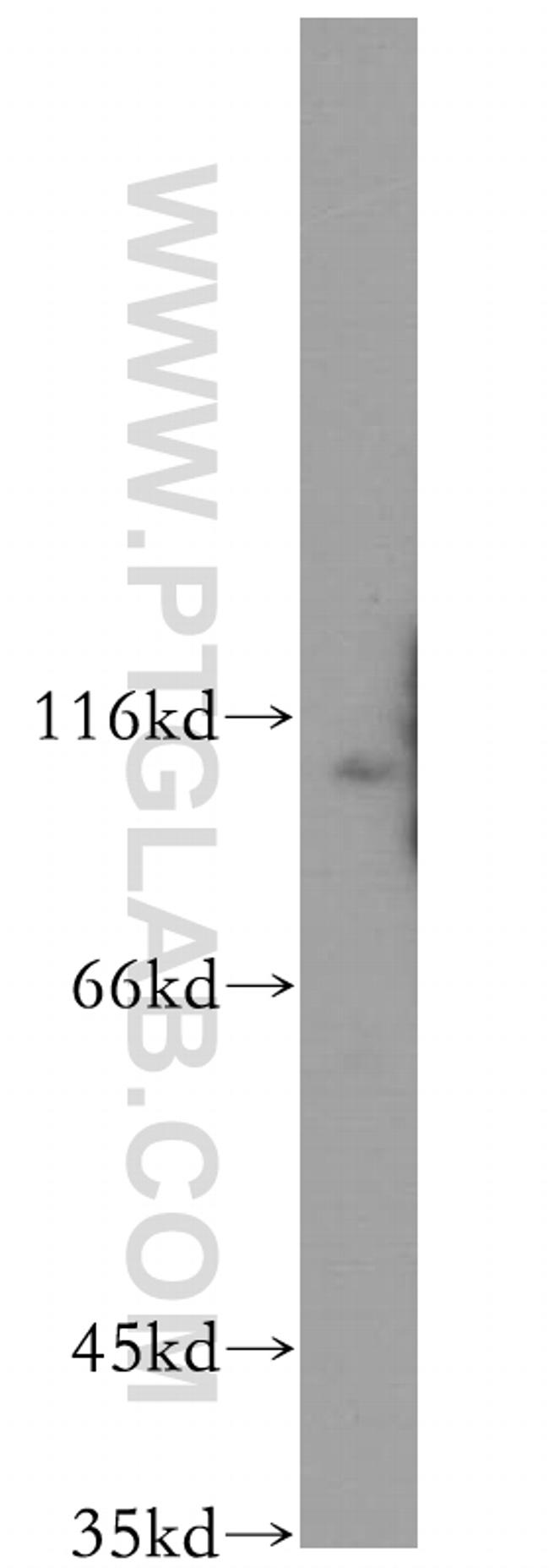 WWP2 Antibody in Western Blot (WB)