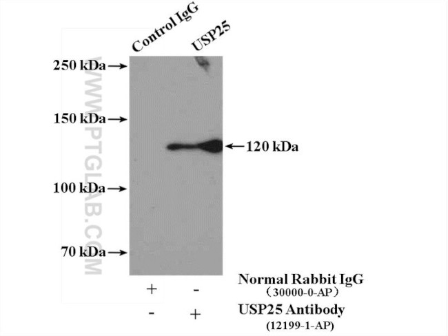 USP25 Antibody in Immunoprecipitation (IP)